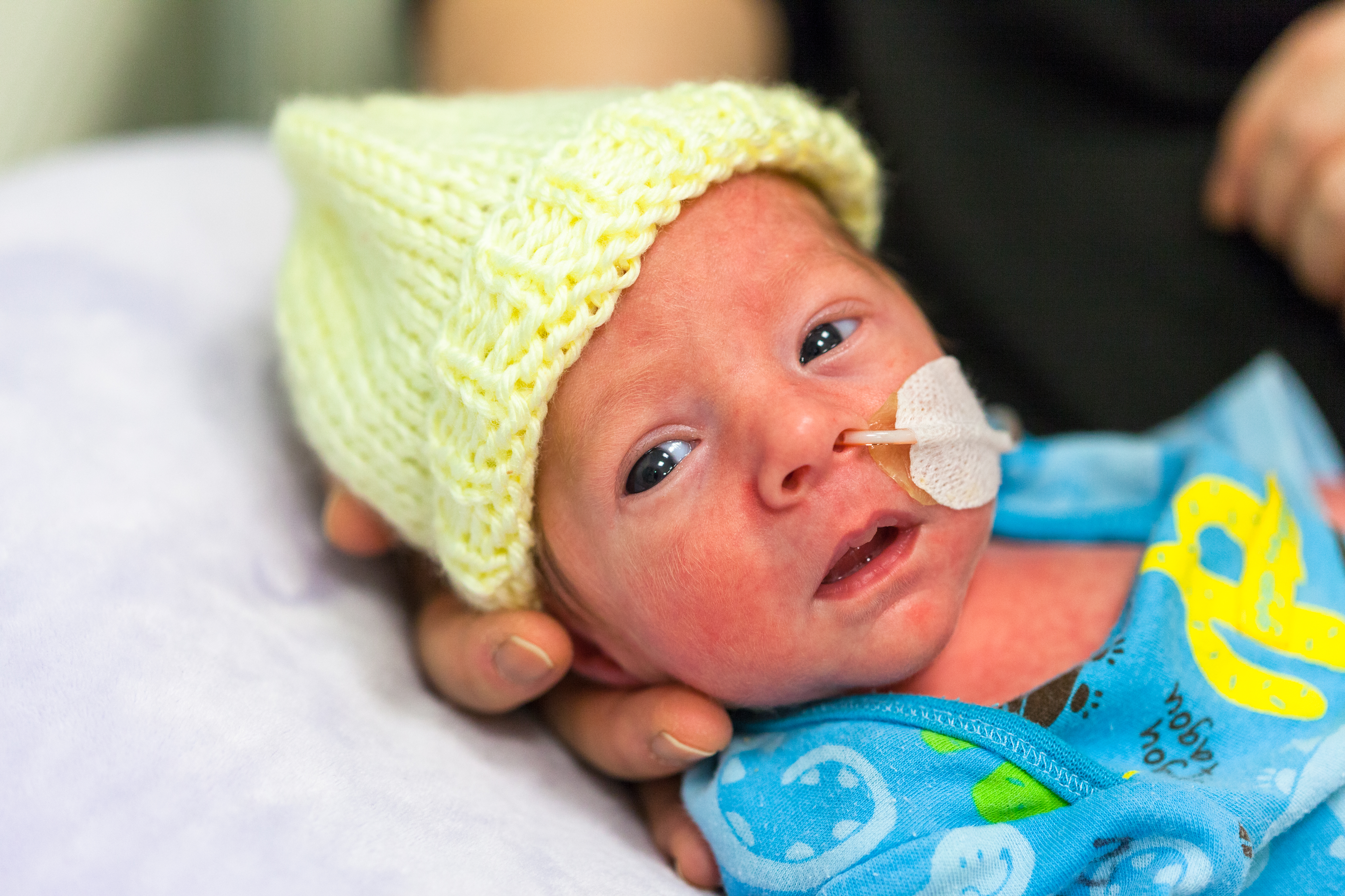 Newborn baby with a feeding tube, wearing a yellow hat and blue outfit, resting in a caregiver’s hand.