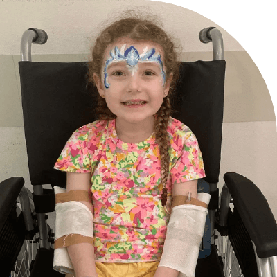 Bec sitting in a wheelchair with bright blue and white facepaint. She has bandages wrapped around her arms. She has a big smile on her face.