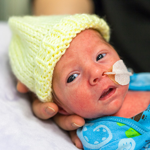 Newborn baby in hospital wearing a yellow beanie has a feeding tube in their nose