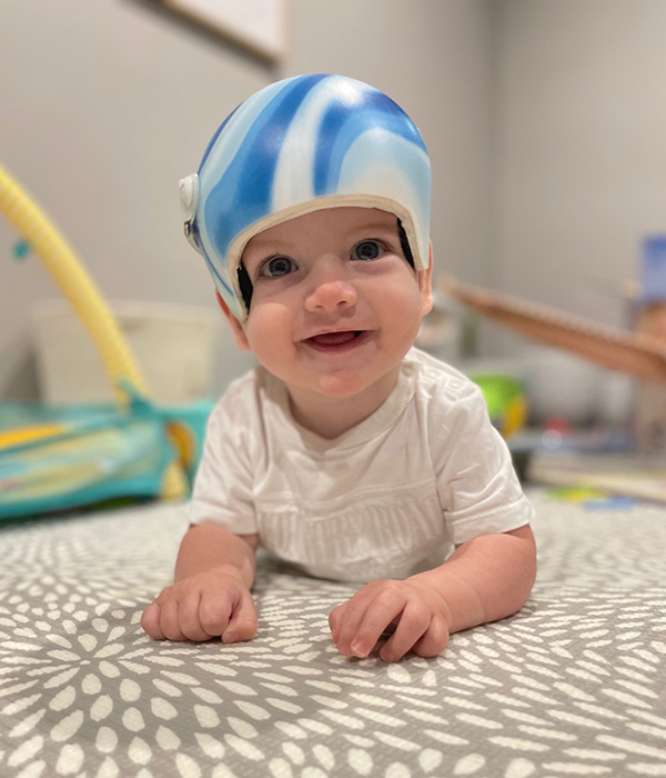 Jackson wearing his blue helmet laying on a playmat smiling