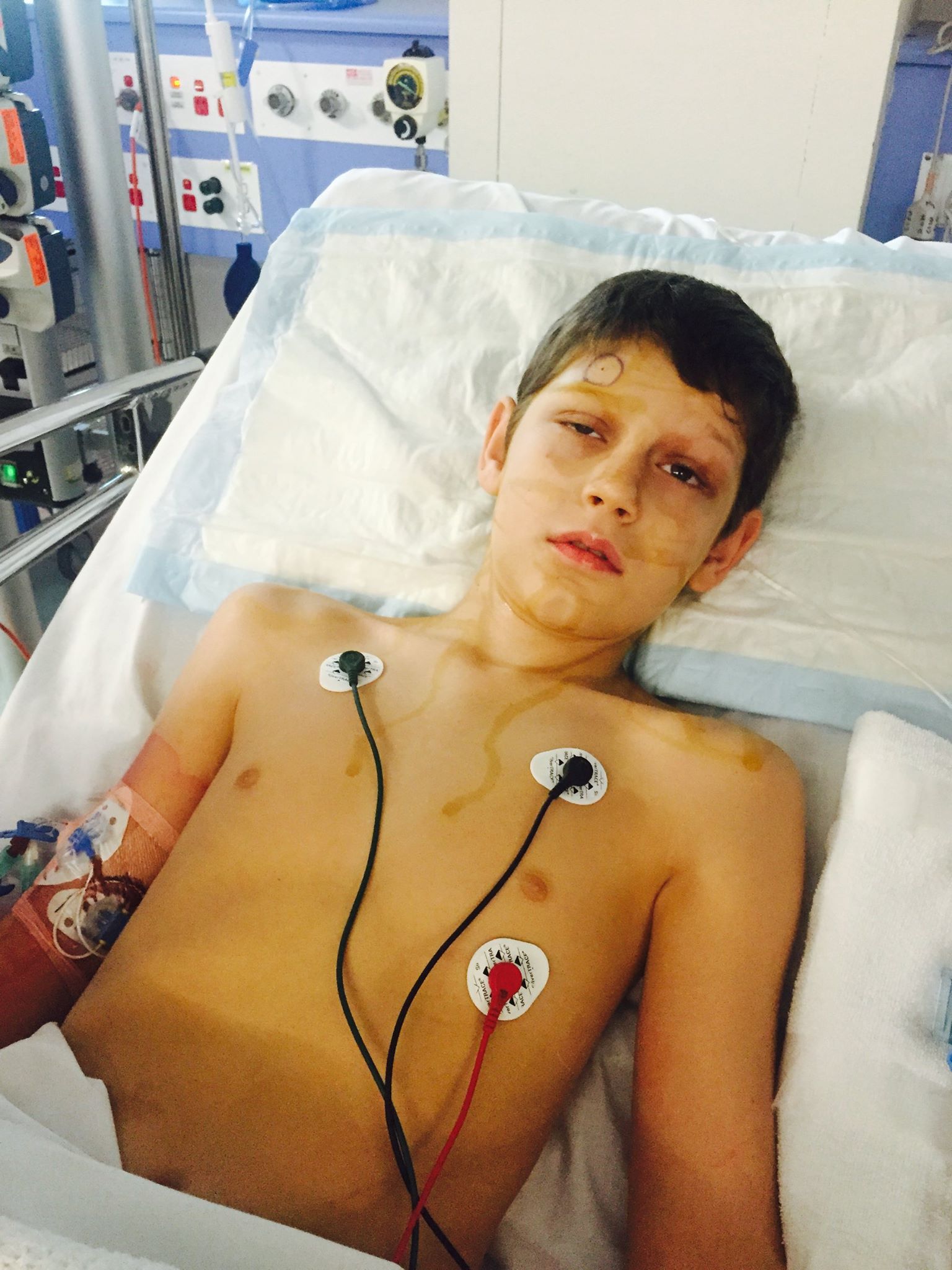 Caleb connected to monitoring devices in hospital